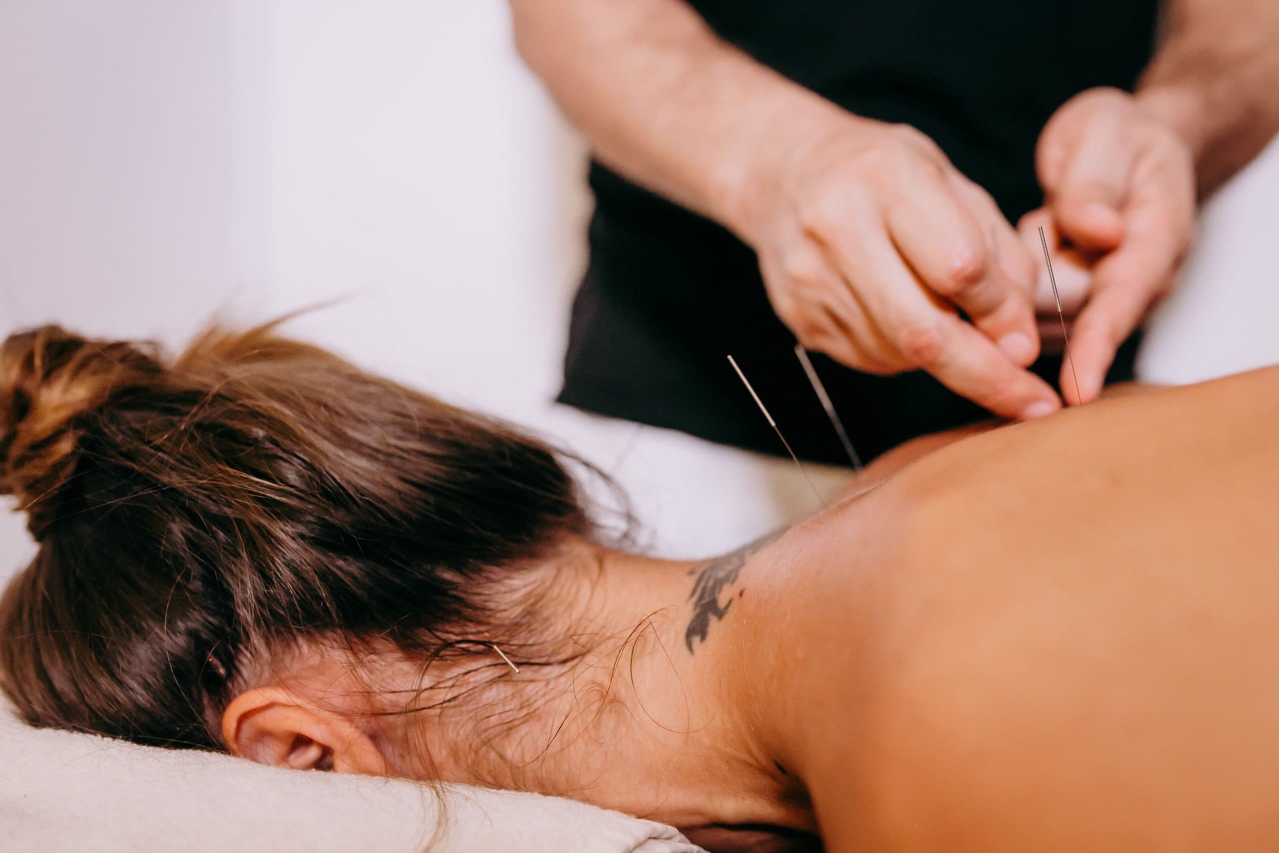 Fysiotherapeut past dry needling toe op de bovenrug van een patiënt